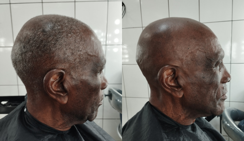 Depois do corte 1